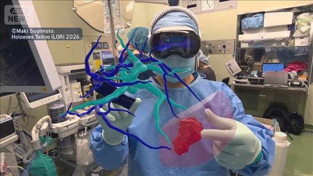 AI×医療で“命を守る” 患部の3D化で医師の負担軽減 日本ならではの課題も