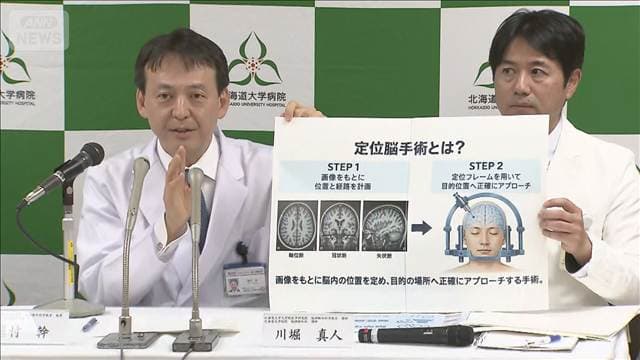 脳損傷まひ患者に国内初治療 再生医療薬「アクーゴ」を投与 北大病院
