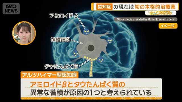 医療の未来予想図 どうなる?感染症・がん・糖尿病 AI診察は【グッド!いちおし】