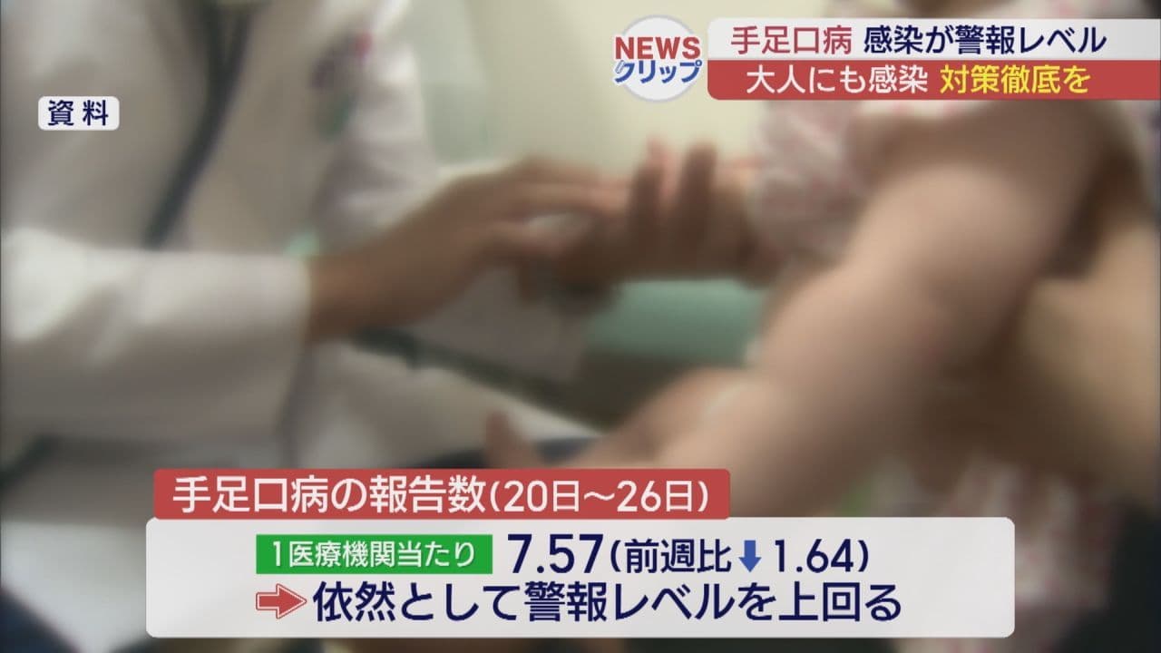 全体は先週より減も会津や相双では増加 手足口病は依然警報レベル