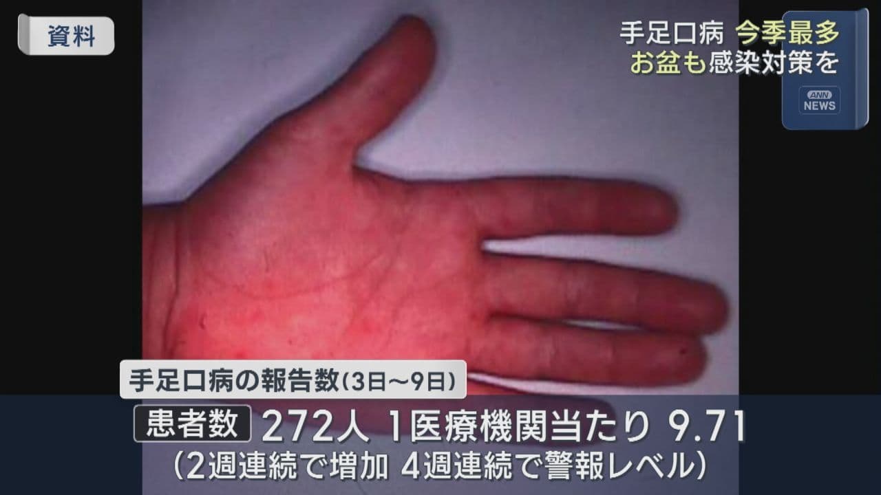 手足口病は依然警報レベル